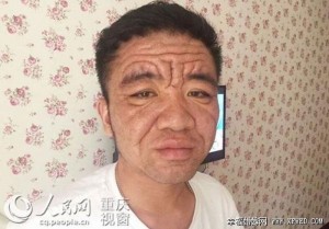 Pria 30 tahun terlihat seperti kakek-kakek karena idap penyakit langka (Foto: Oddity Central)