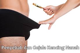 Penyebab Buang Air Kecil Nyeri & Bernanah pada Pria. (Foto : istimewa)